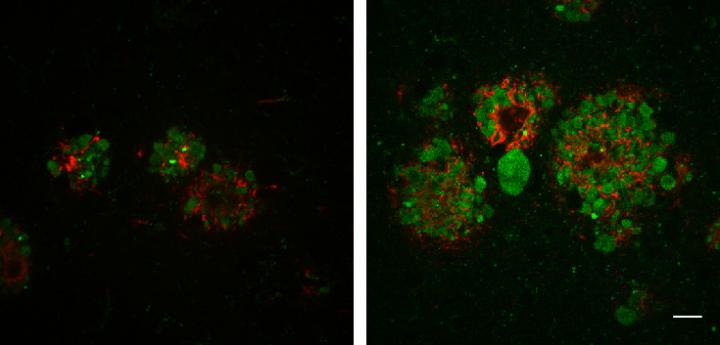 Lower JIP3 Levels Enhance Amyloid Plaque Formation