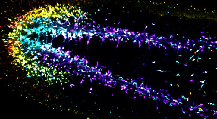 Pattern of the Planarian Brain