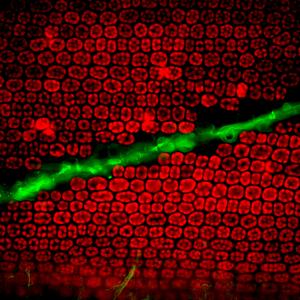 Wasting disease invastion