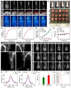 Complete tumor ablation and fluorescence-guided surgery with TTBT-d28 nanoparticles in mouse models