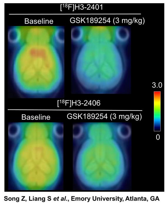 Representative summed PET images of brain uptake