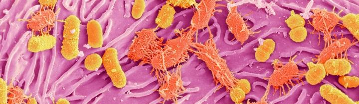 Microbiome