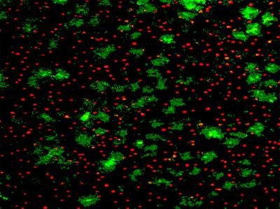 Biofilm Defense