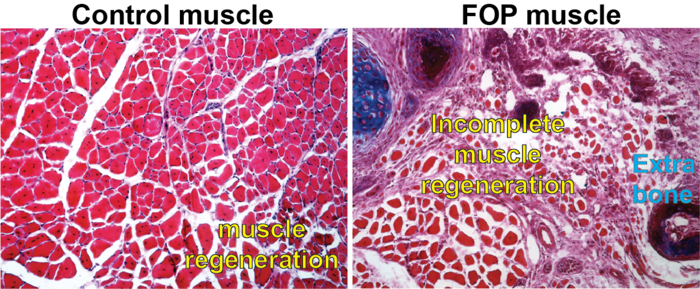 Comparison of control and FOP cell