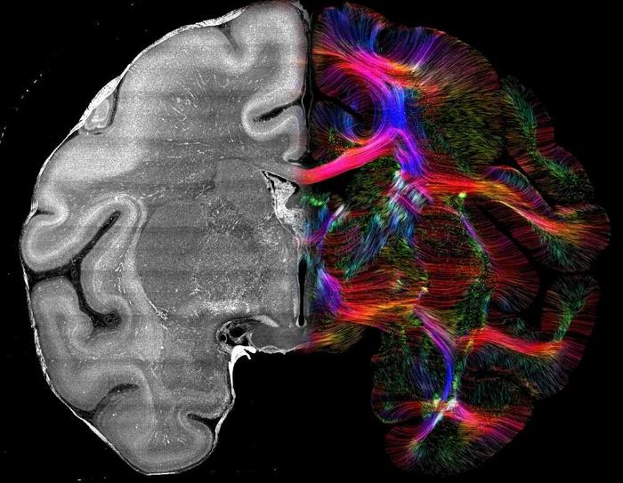 Nissl staining and CABLE-reconstructed fibers