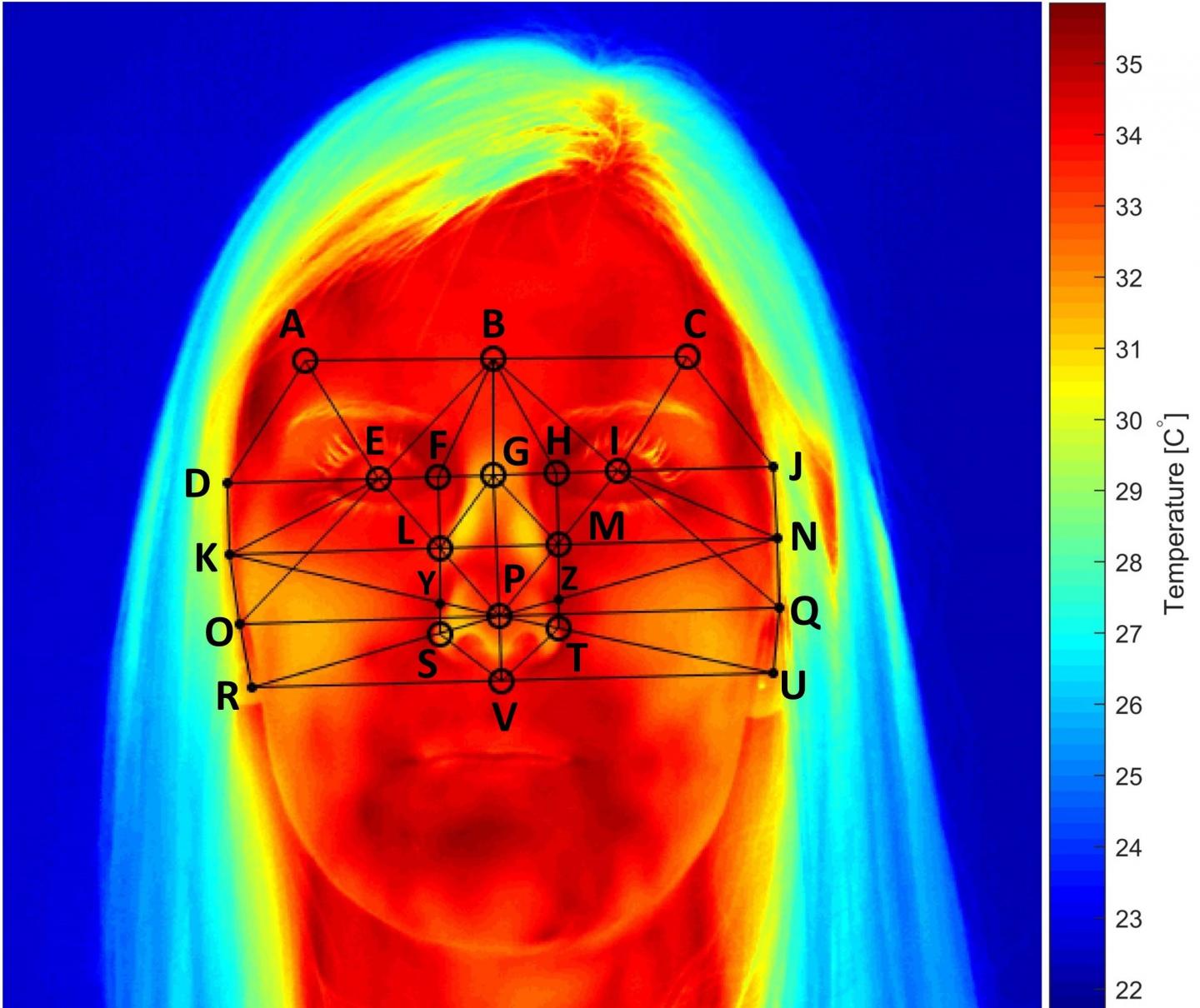 Thermal Image