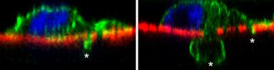 Tumor Cell Follows Invadopodium through Basement Membrane