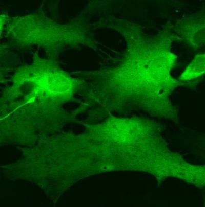 Astrocytes