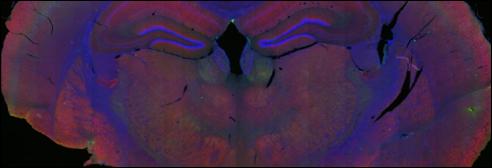 Brain