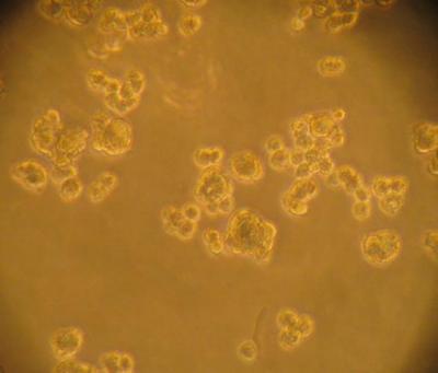 Tumor Spheroids