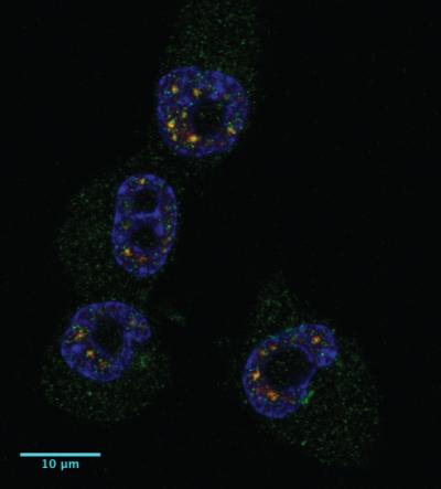 Localization of CPEB1