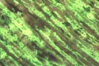 Alphavirus Antigen, Brain