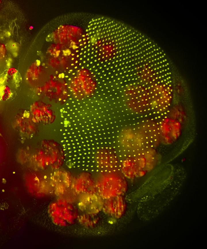Fat Body Cells in Fly Pupa Eye