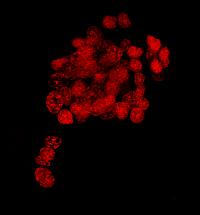 Cluster 10 Cells