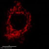 Research Points to a New Way to Protect Kidneys Threatened by Insufficient Blood or Toxins