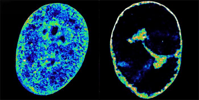 Human cells before and after infection