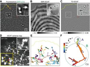 Figure 1. Diverse movements of autophagosomes within the crowded cytoplasm of a living cell