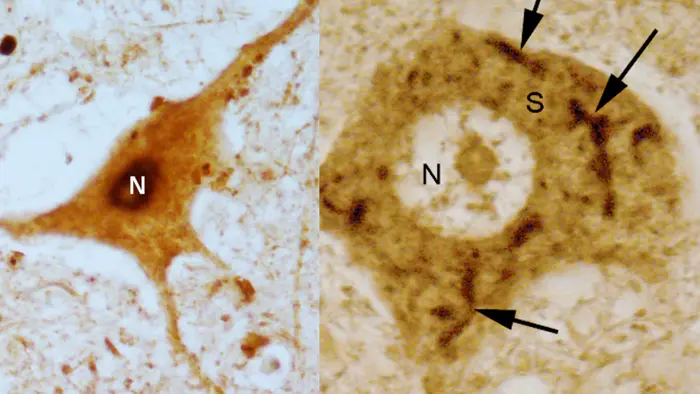 Spinal cord motor neurons