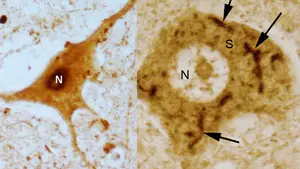 Spinal cord motor neurons
