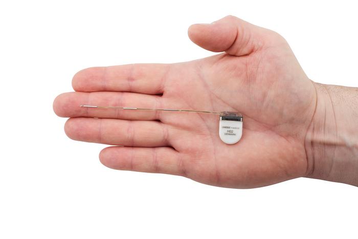 The subcutaneous electroencephalography (sqEEG) system is about the size of a UK pound coin and has a small 10cm wire attached