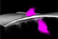 An Immune Cell