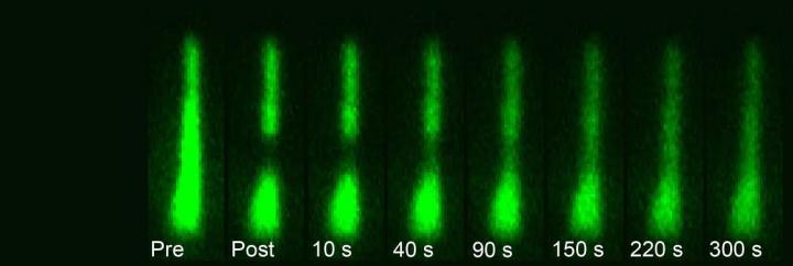 Rapid Movement Of Protein In Single Hair Bundle In Inner Ear