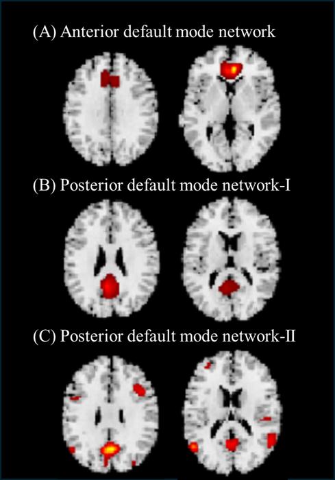 Plasma vitamin C levels are associated with brain structural networks on MRI: A large cohort study