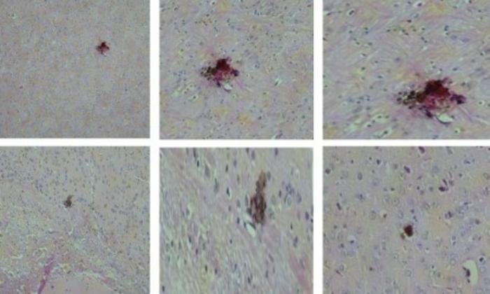 Vaccine against Zika virus shows promising results in tests with mice