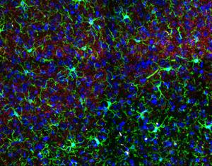 Microglia