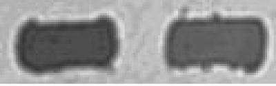 Immunoglobulin G With Optimized Polarization