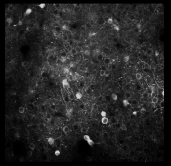 Neural Activity in the PPC (Still)
