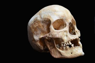 Skull