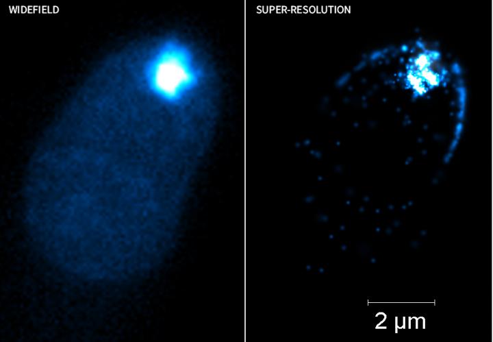 Super-Resolution Microscopy