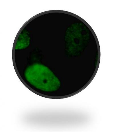 Damage to Human Fibroblasts