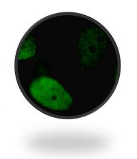 Damage to Human Fibroblasts
