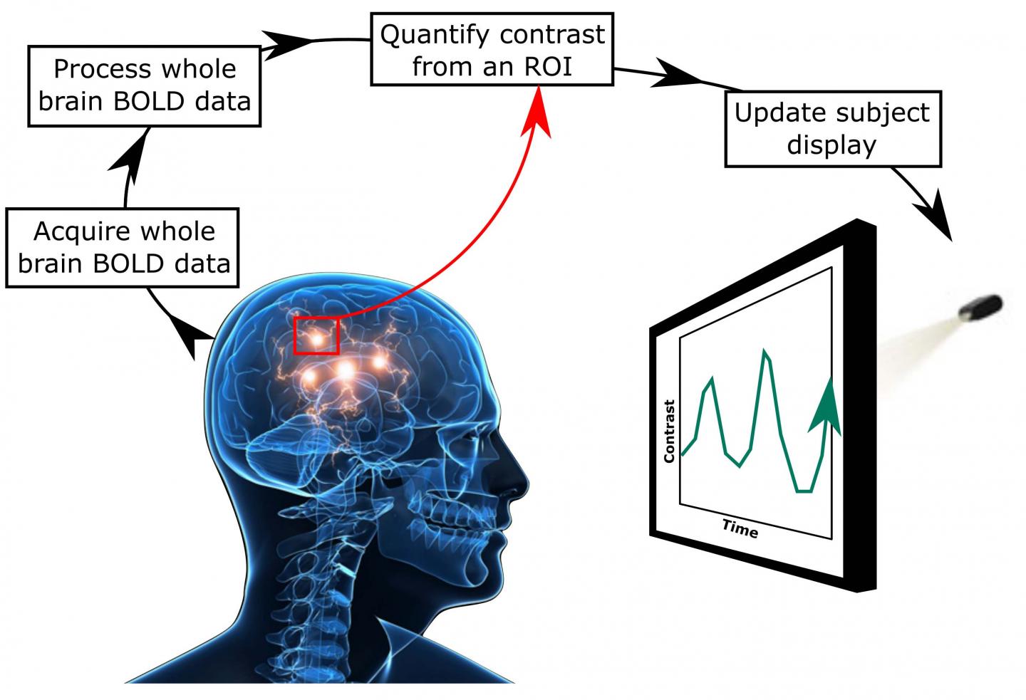 Neurofeedback Shows Promise in Treating Tinnitus 1
