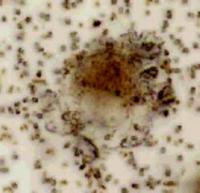 Dendritic Cell Engulfs Probiotic Vaccine (2 of 2)