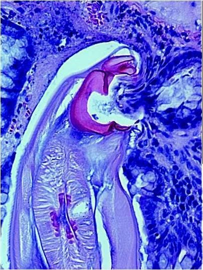 Hookworm Attached to a Human Intestine