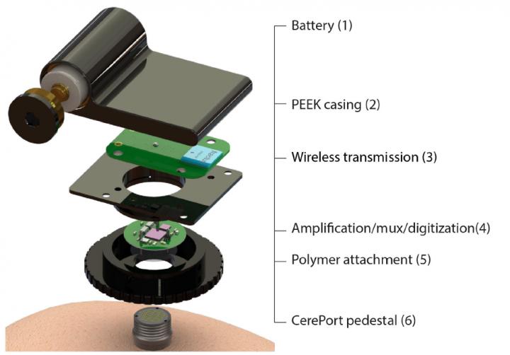 Wireless Neurosensor