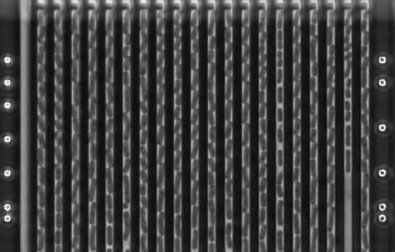 <i>Klebsiella pneumoniae</i>