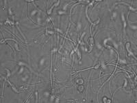 Slow-moving Sperm