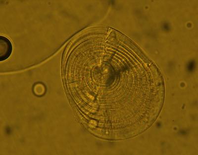 Otolith