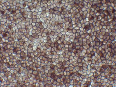 Retinal Pigment Epithelium Cells Derived From Human iPS Cells