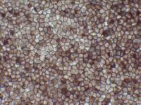 Retinal Pigment Epithelium Cells Derived From Human iPS Cells