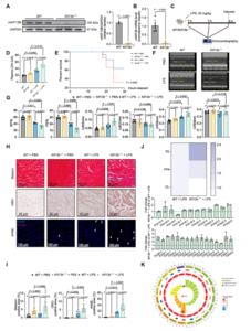 Fig.2. KIF13B deficiency exacerbates sepsis-induced cardiac dysfunction by disrupting myocardial lipid metabolism