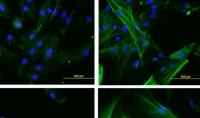 Scleroderma