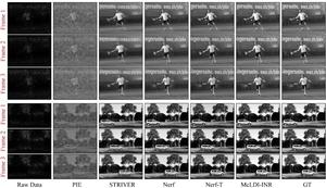 Visual Comparison between McLDI-INR and Baseline Methods