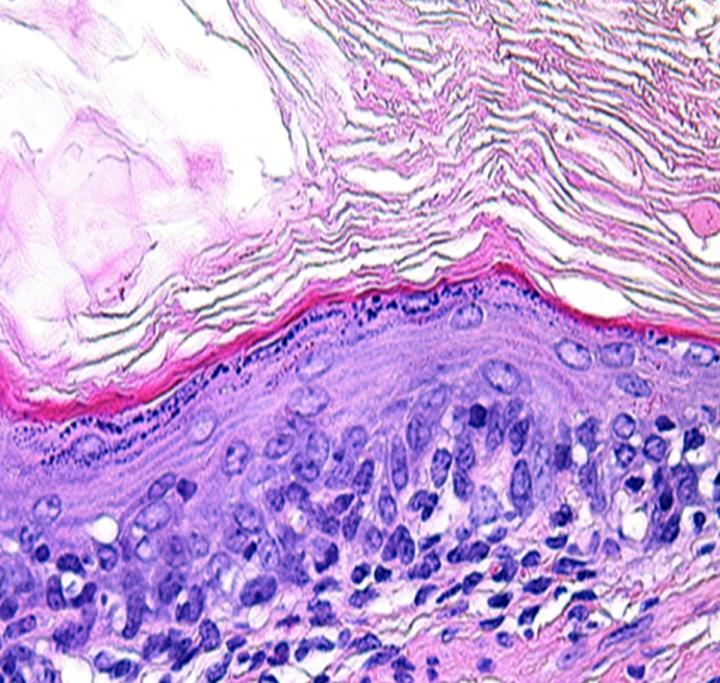 Tissue-Engineered Esophagus