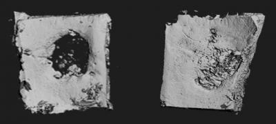 Regrown Bone