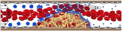 Shear-Activated, Drug-Delivering Nanotherapeutic